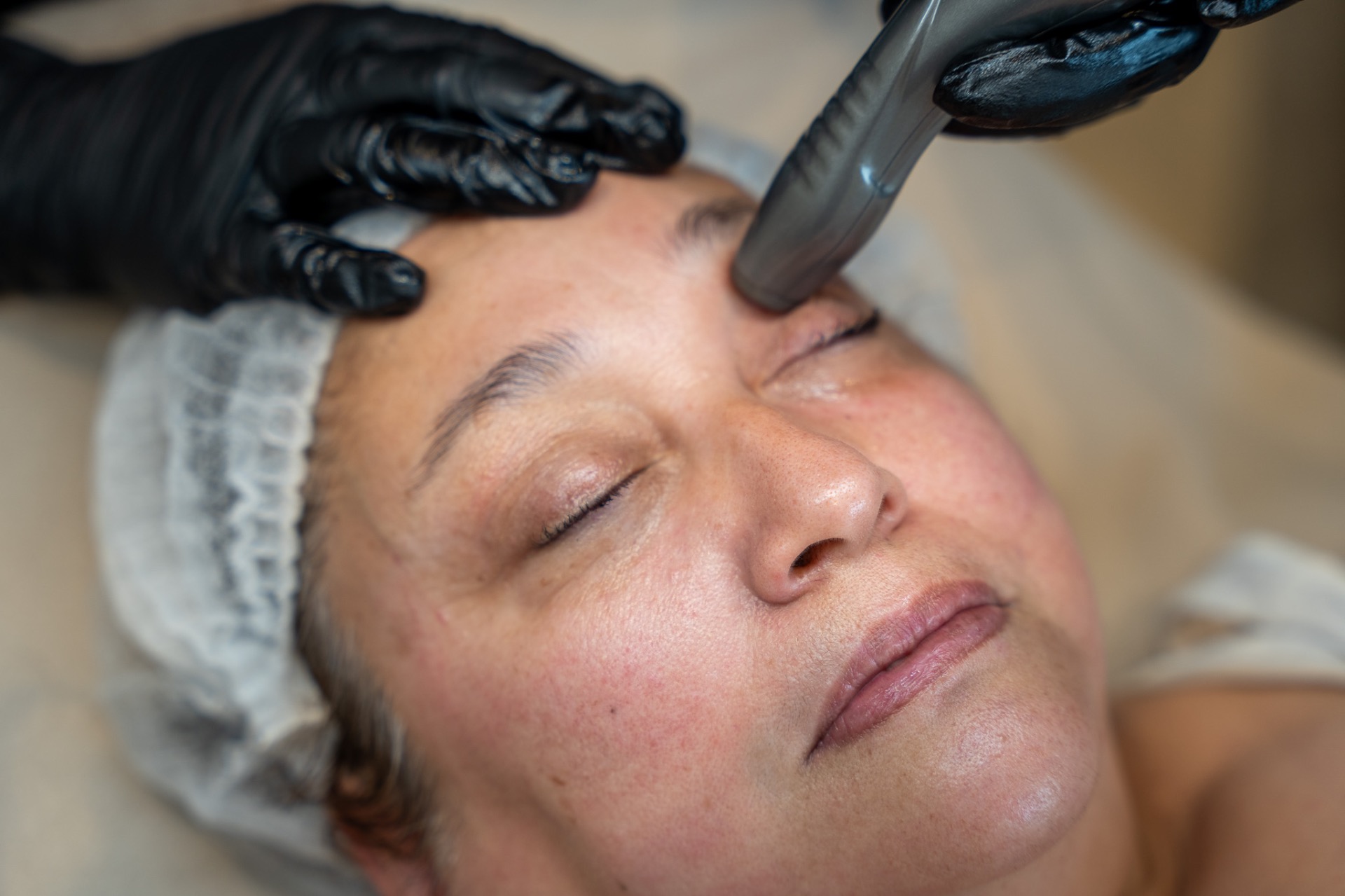 Wrinkle eraser voor de oogleden